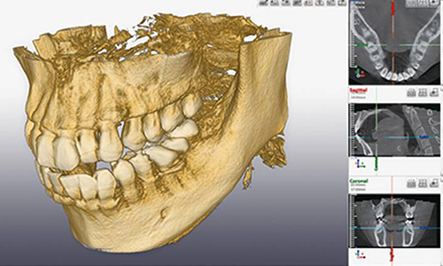 インターパーク（宇都宮・雀宮）の歯医者、こうだい歯科の歯科用CT